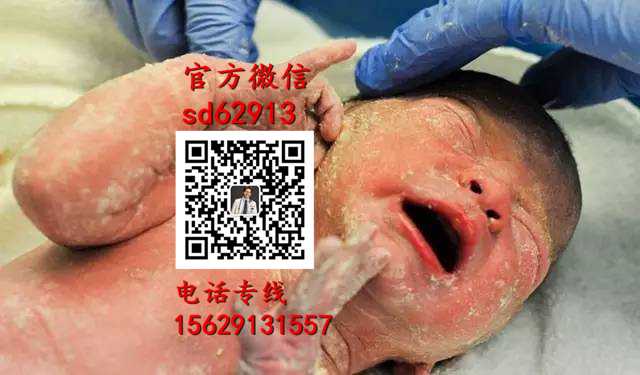 杭州高鹰代孕官网：2020年代孕价格查询_代孕医院怎么联系