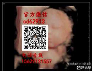 杭州吕梁代孕网：哪里有不孕不育助孕_一条龙助孕服务
